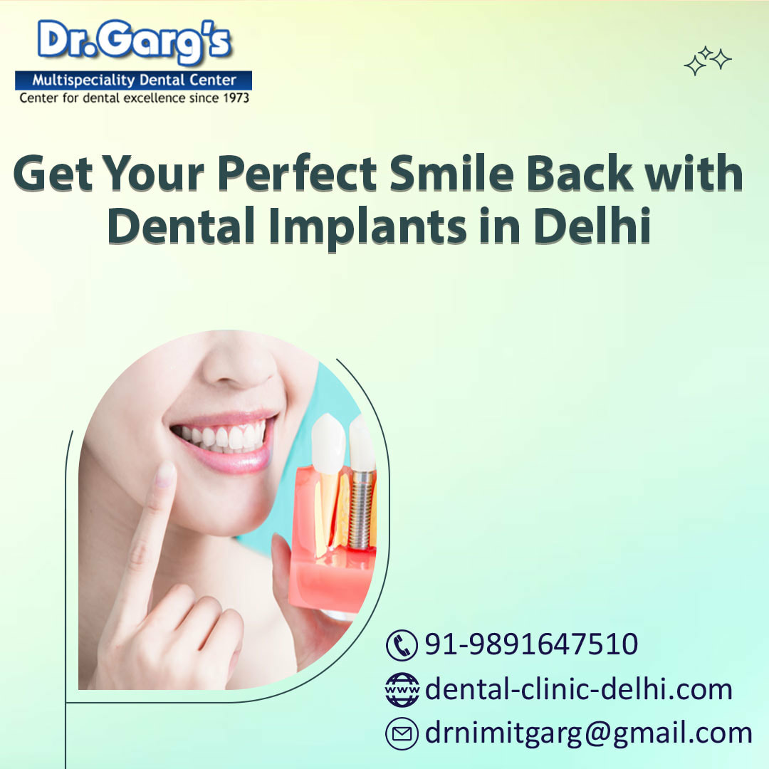 Get Your Perfect Smile Back with Dental Implants in Delhi - Image 1