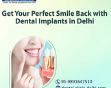 Get Your Perfect Smile Back with Dental Implants in Delhi